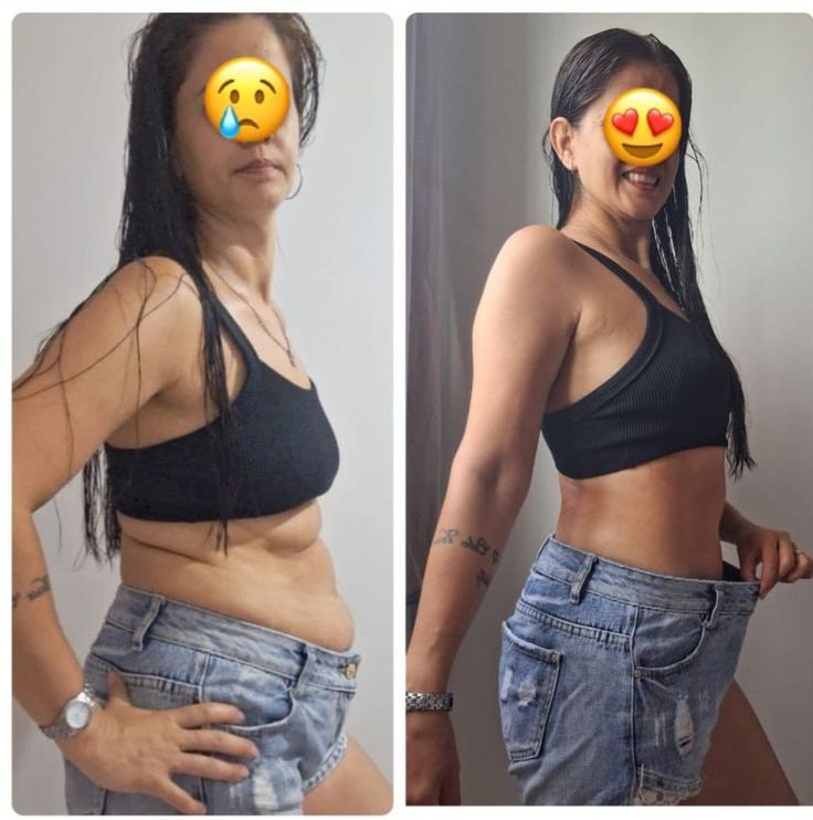 Antes e depois de cliente Dietapp
